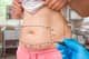 Slider image (7) Dr. Asim Uslu - Plastic Surgeon in Antalya, Turkey